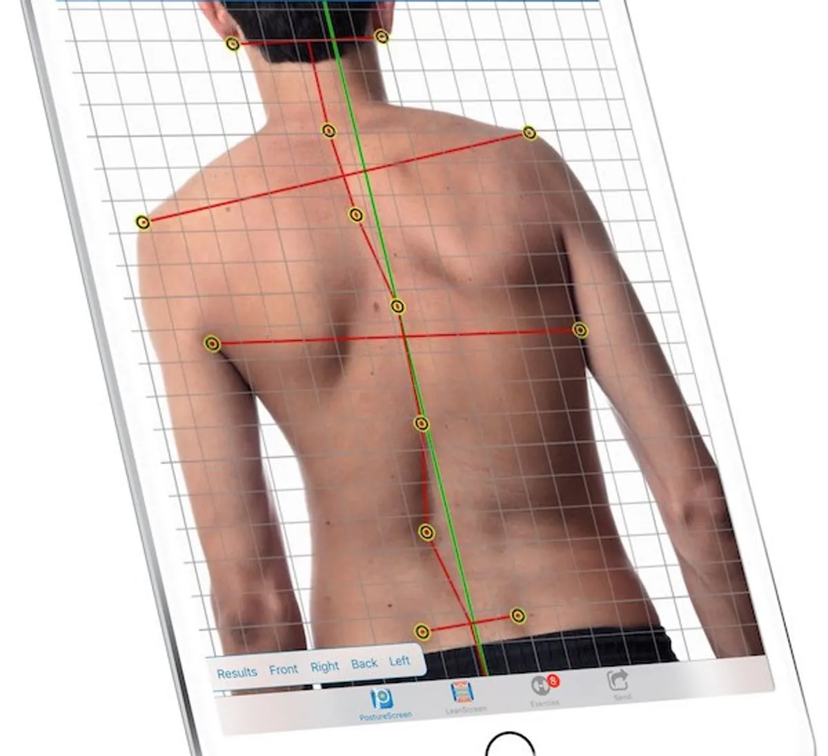 Posture screening analysis